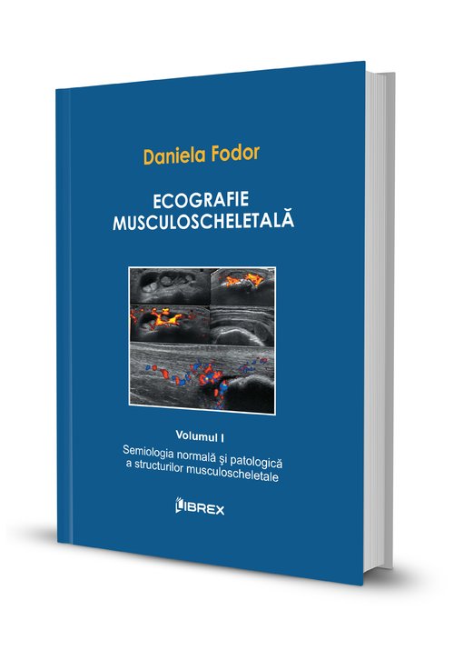 Vezi detalii pentru Ecografie musculoscheletală - Daniela Fodor - Vol. I