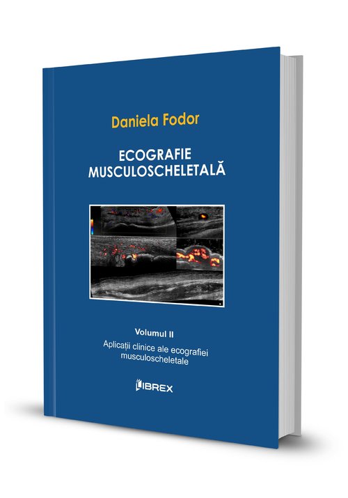 Ecografie musculoscheletală – Daniela Fodor – Vol. II Librex Publishing poza 2022